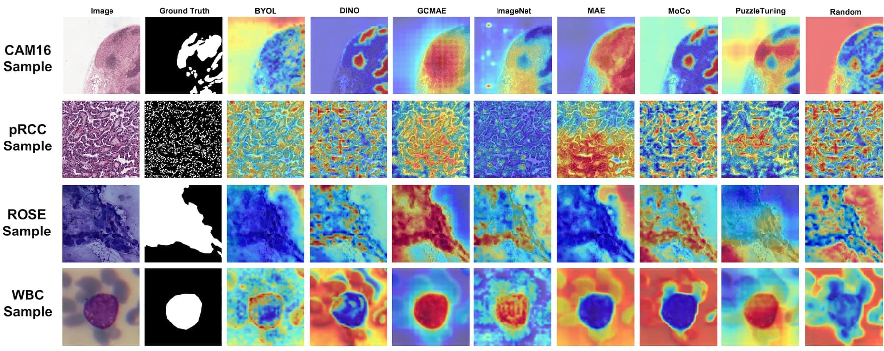 Class-activation visualizations across CAM16, pRCC, ROSE and WBC examples.