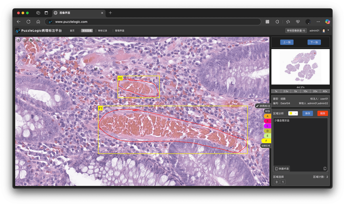 PuzzleVision Platform