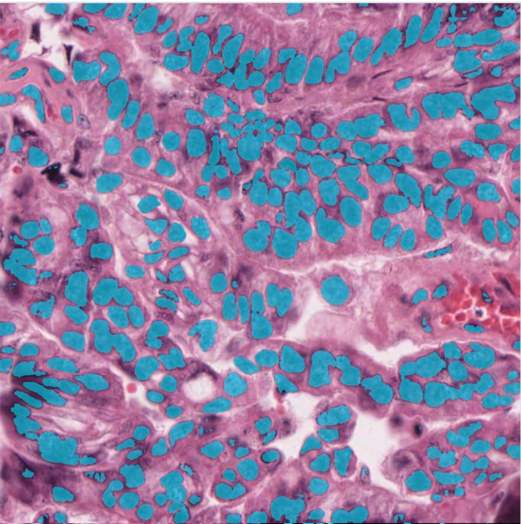 200× Individual nuclei mask