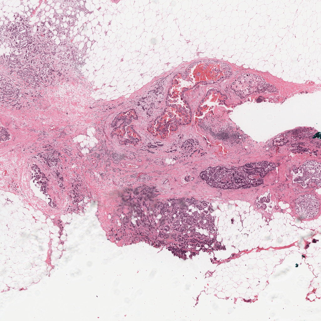 10× raw pathology field