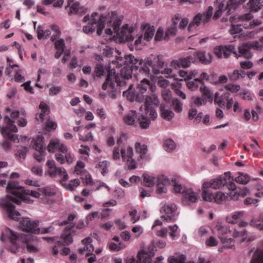 200× raw pathology field
