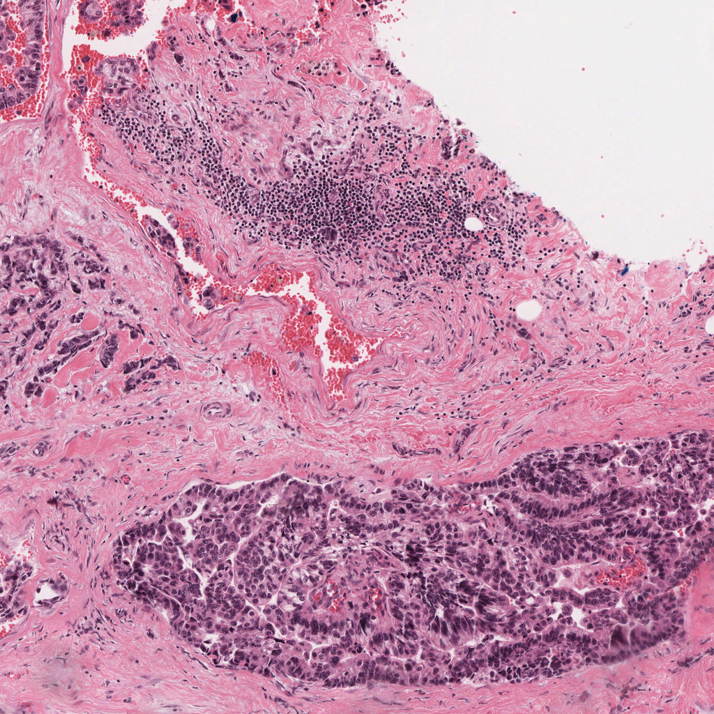 40× raw pathology field