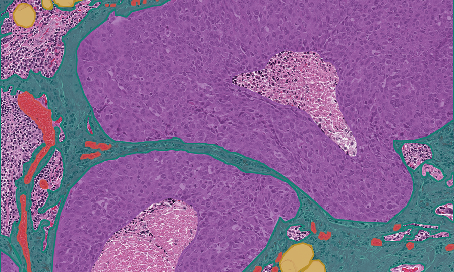 Composite segmentation mask with four classes